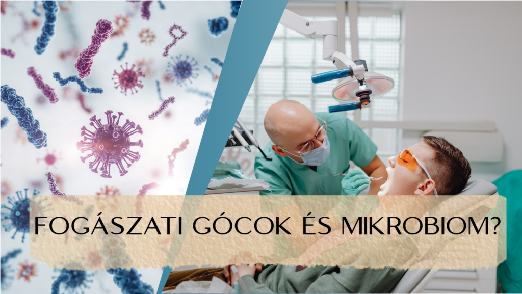 Fogászati gócok és a mikrobiom - utazás a mikrobiom körül